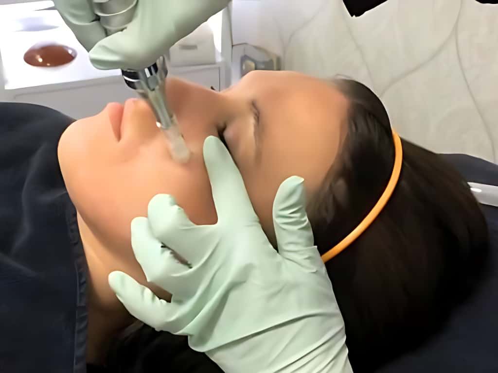 Collagen Induction Treatment at Vanity Lab Med Spa