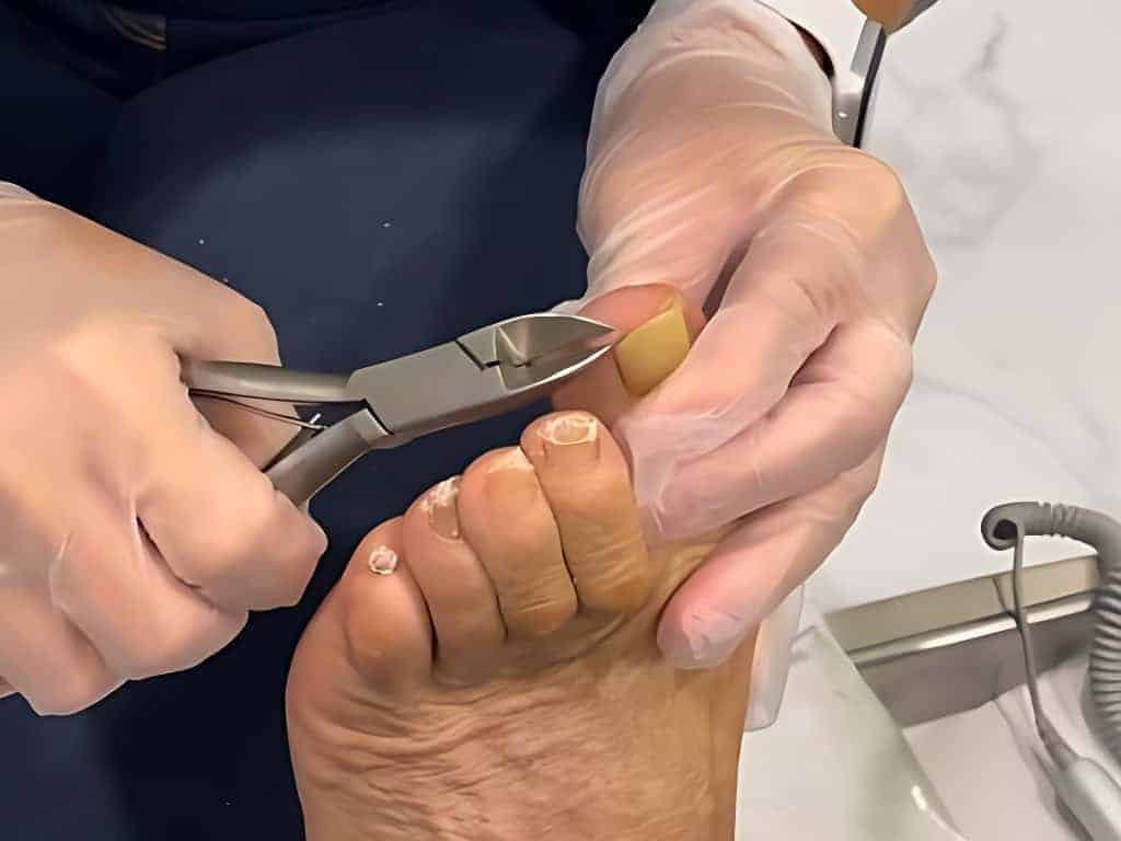 ThuLan Nail Retreat Diabetic Pedicures